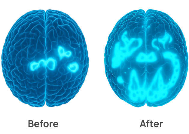 Illustration of brain wellness before and after treatment
